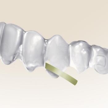 Ortho Clear Collection - Tear Drop kleště (Hu-Friedy)